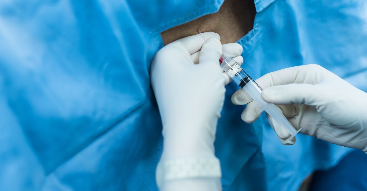 anestesista somministra anestesia epidurale ad un paziente