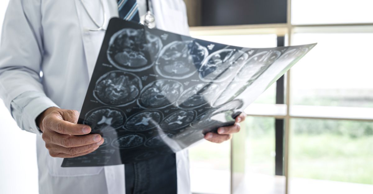 Medico in camice bianco che osserva attentamente una lastra di risonanza magnetica cerebrale, con immagini del cervello, alla luce naturale proveniente da una finestra.