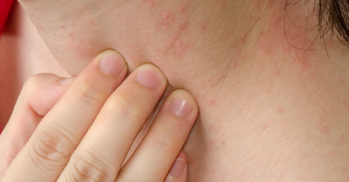 Una donna che si tocca un brufolo sul collo