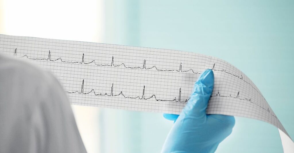 tracciato di elettrocardiogramma