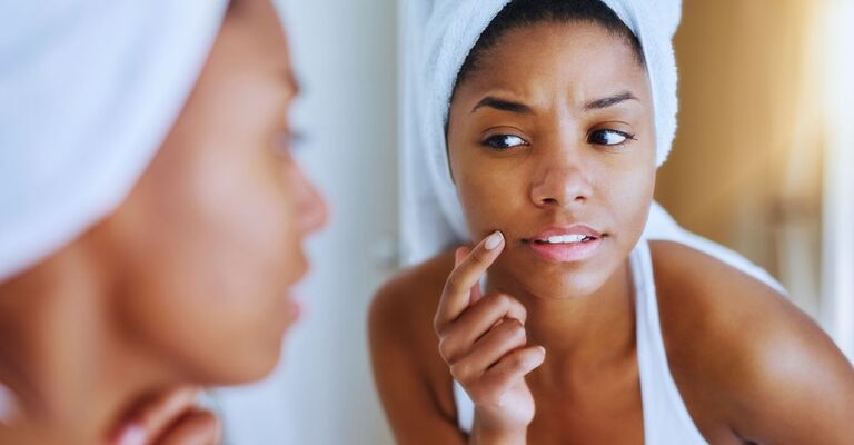 Una donna si guarda allo specchio indicando uno sfogo sul viso