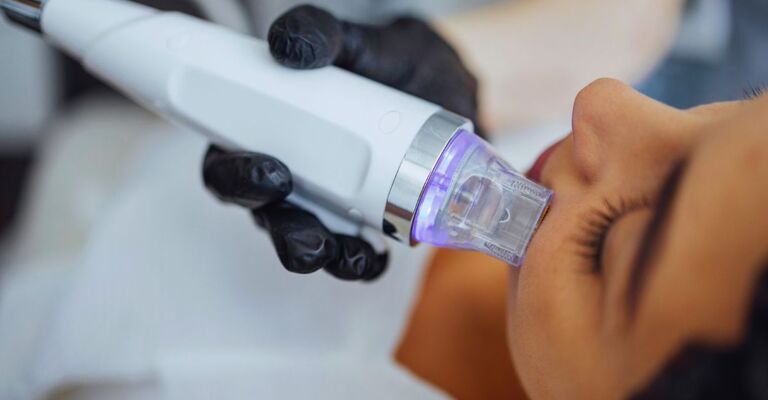 Seduta di microneedling con dispositivo avanzato a luce LED su donna distesa, trattamento estetico per il ringiovanimento cutaneo del viso.