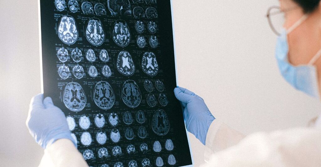 Medico osserva scansioni cerebrali su lastra radiografica, concetto di ricerca neurologica e studi sul cervello.