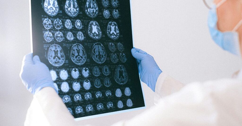 Infiammazione cronica e cervello: una nuova frontiera per la salute mentale