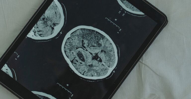 Una radiografia del cervello.