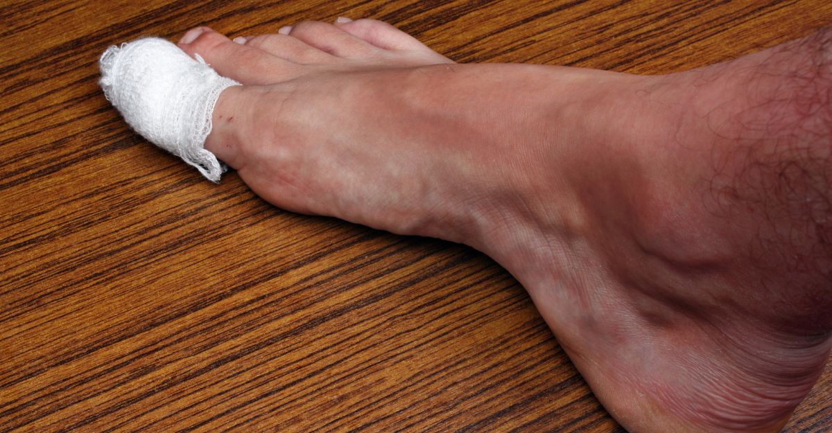 Piede con dito fasciato a causa di un infortunio, bendaggio bianco applicato sull’alluce.