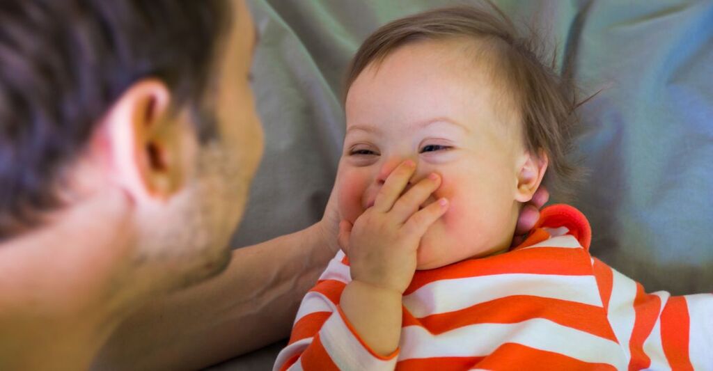 Una bambina con sindrome di down che sorride.