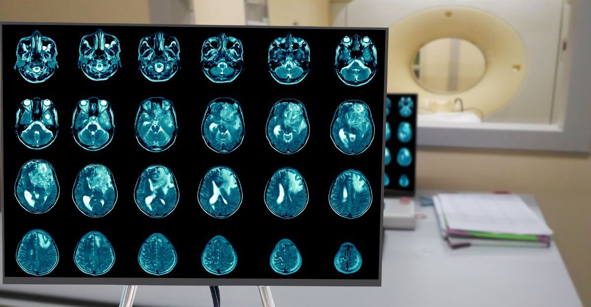 Radiografie del cervello.