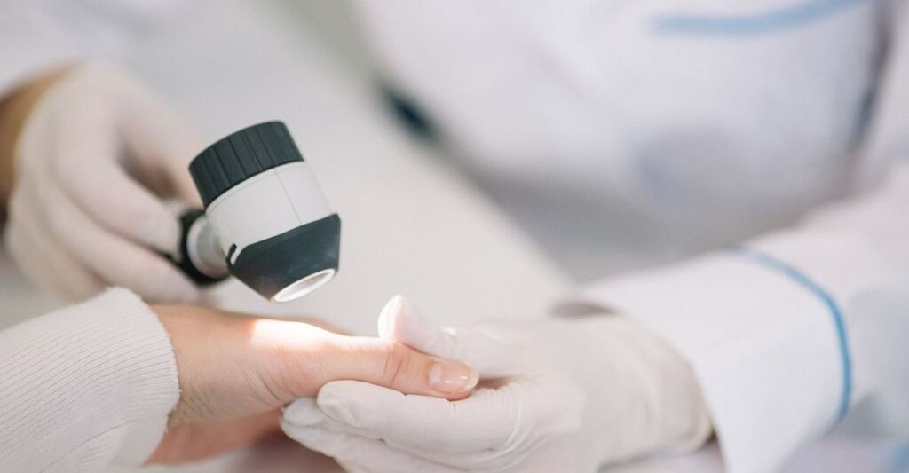 Primo piano di un dermatologo che esamina la mano di un paziente con un dermatoscopio.