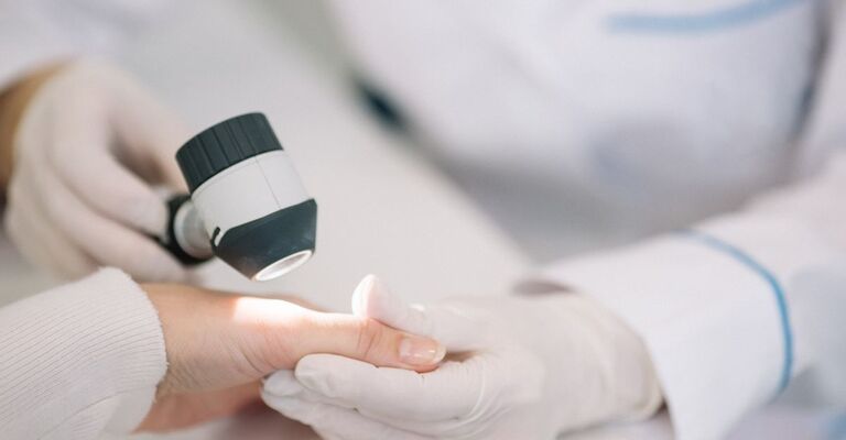 Primo piano di un dermatologo che esamina la mano di un paziente con un dermatoscopio.