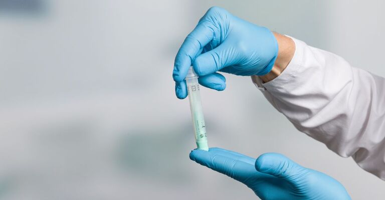 La mano del medico nei guanti medici tiene una provetta per un campione di feci per lo screening del cancro al colon