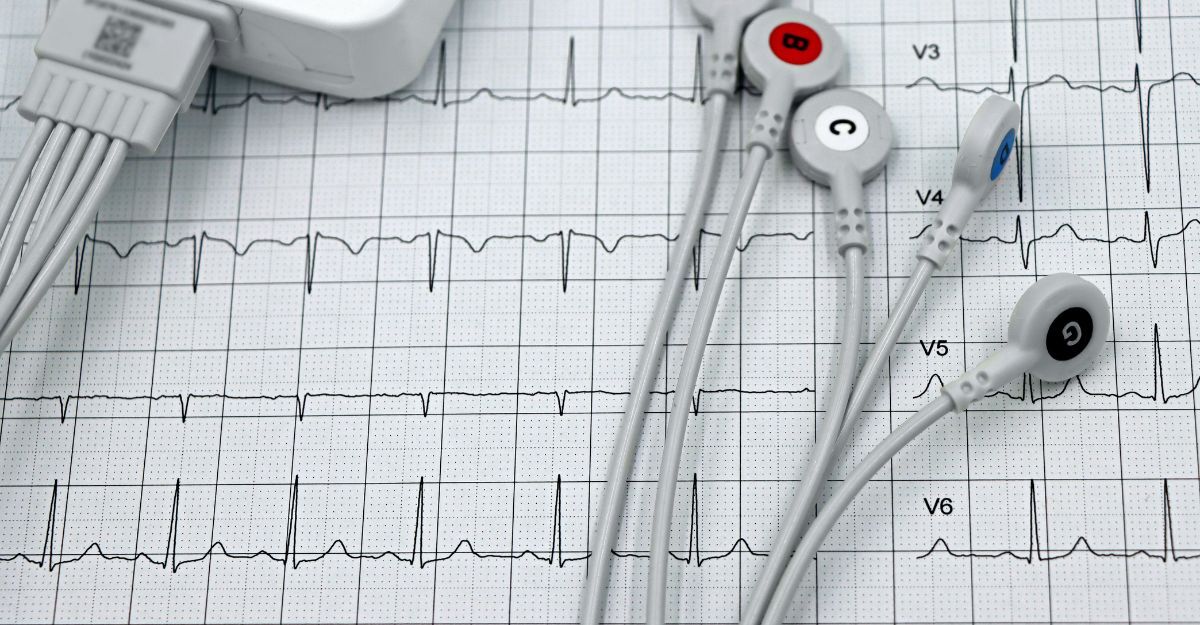 Arresto cardiaco, l’intelligenza artificiale ridisegna la prevenzione cardiovascolare tracciato ECG e sensori ECG