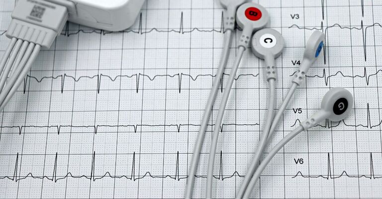 Arresto cardiaco, l’intelligenza artificiale ridisegna la prevenzione cardiovascolare tracciato ECG e sensori ECG