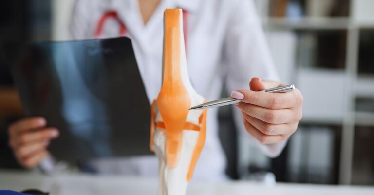 Il medico traumatologo esamina la radiografia e le gambe e il modello dell'articolazione del ginocchio. Concetto di lesioni e distorsioni