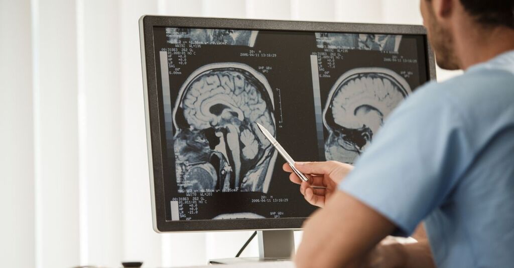 Medico che indica una risonanza magnetica cerebrale su uno schermo.