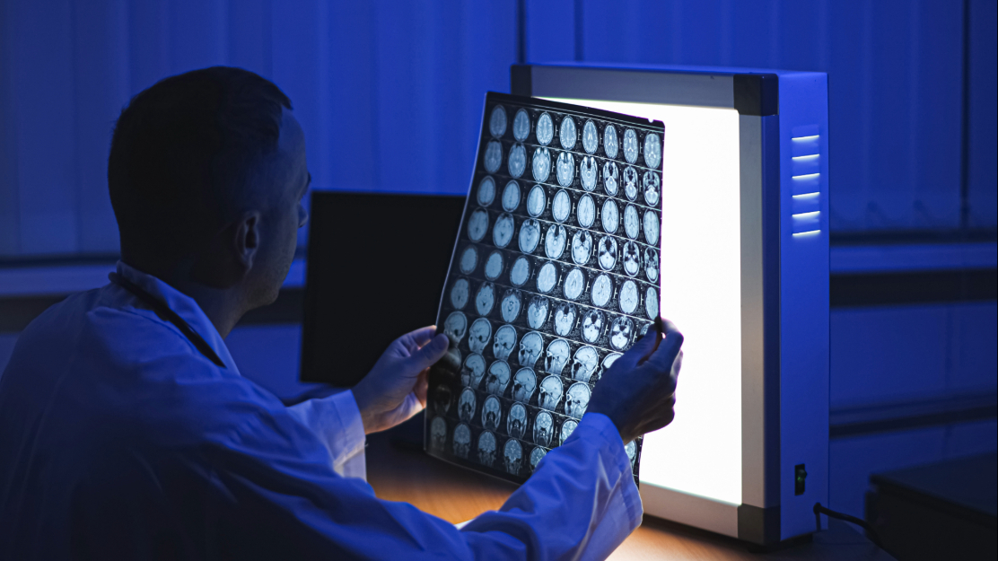 Un medico osserva una lastra di un cervello