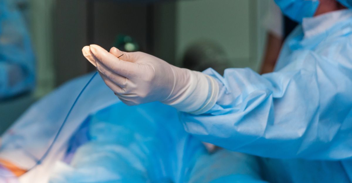 Trattamento delle malattie vascolari con angiografia