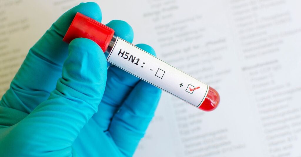 Provetta H5N1 positiva per influenza aviaria.