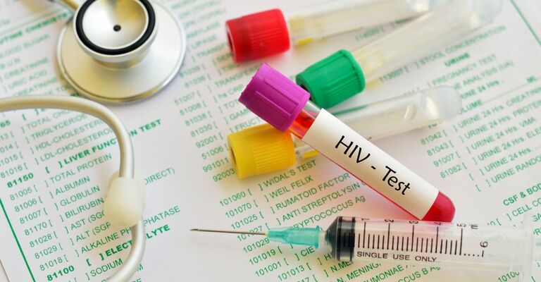 test per hiv e fogli da compilare