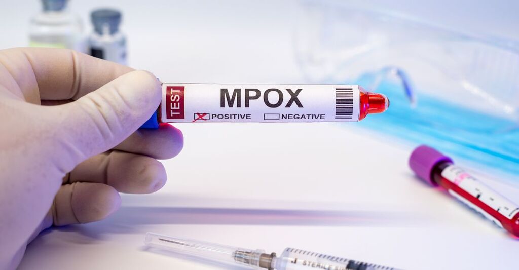 Provetta per test Mpox positiva