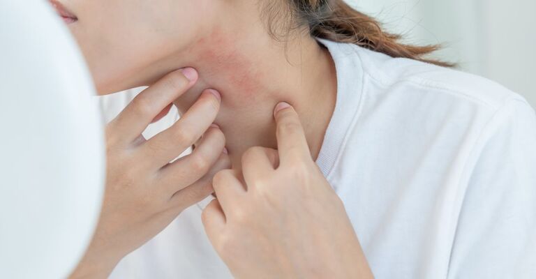 ragazza si guarda allo specchio e si gratta il collo irritato
