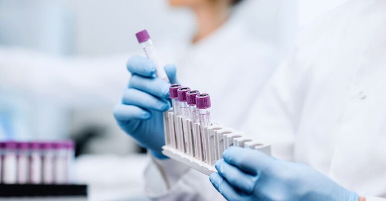 Assistente di laboratorio che inserisce le provette nel supporto, primo piano focalizzato sulle provette