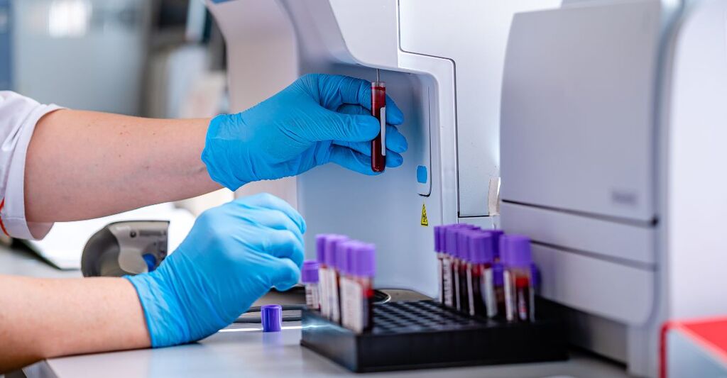 Analisi delle provette in un ambulatorio ospedaliero. Laboratorio moderno per analisi del sangue