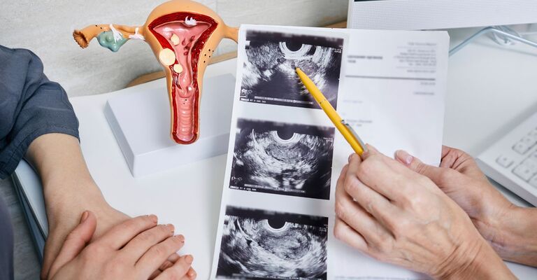 Medico che indica i risultati di un'ecografia accanto a un modello anatomico dell'utero