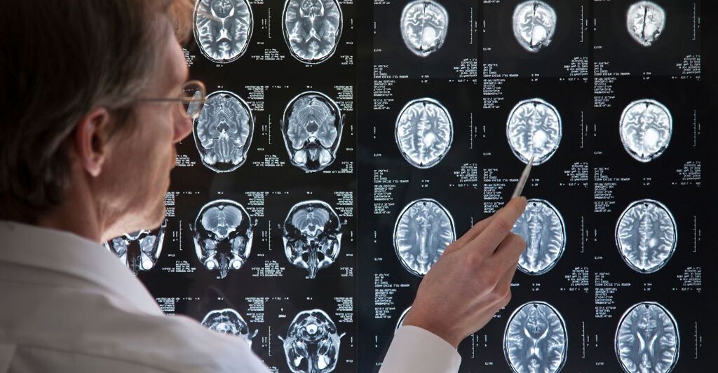 Un medico osserva una lastra di un cervello