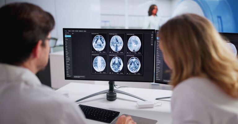 Neuroradiologi maschio e donna che monitorano la risonanza magnetica cerebrale