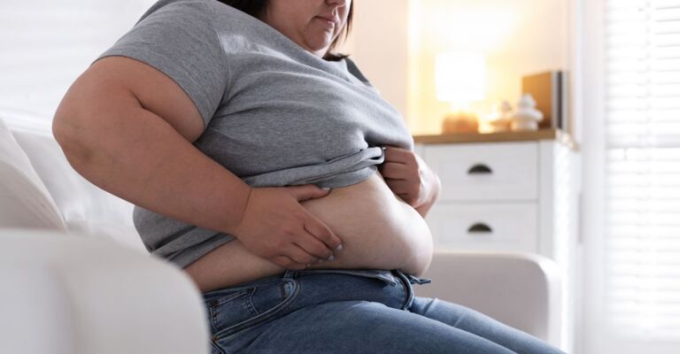 Una donna con obesità si guarda la pancia.