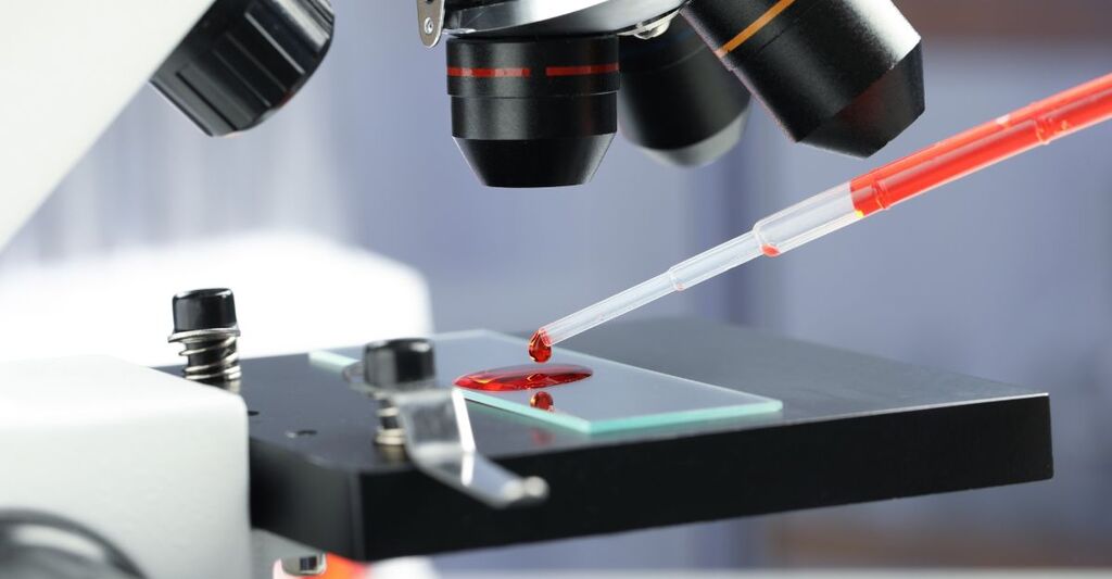 vetrino al microscopio