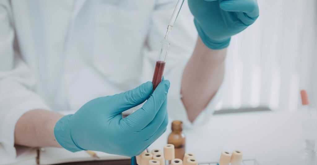 esami_del_sangue_in_laboratorio