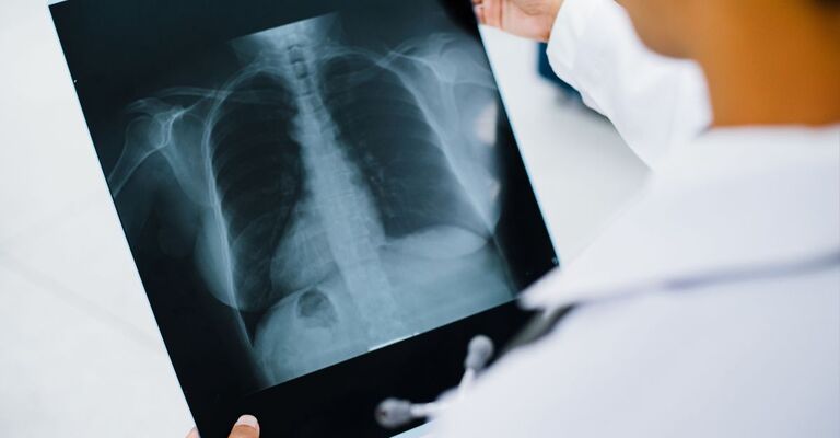 Medico con radiografia toracica 