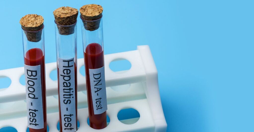 Test per l'epatite A.