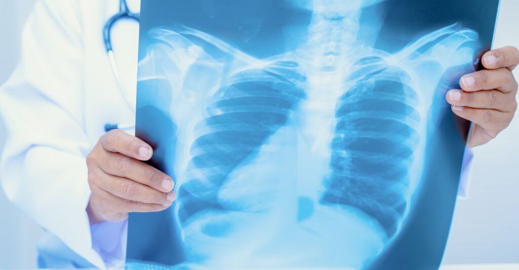 Una radiografia della cassa toracica