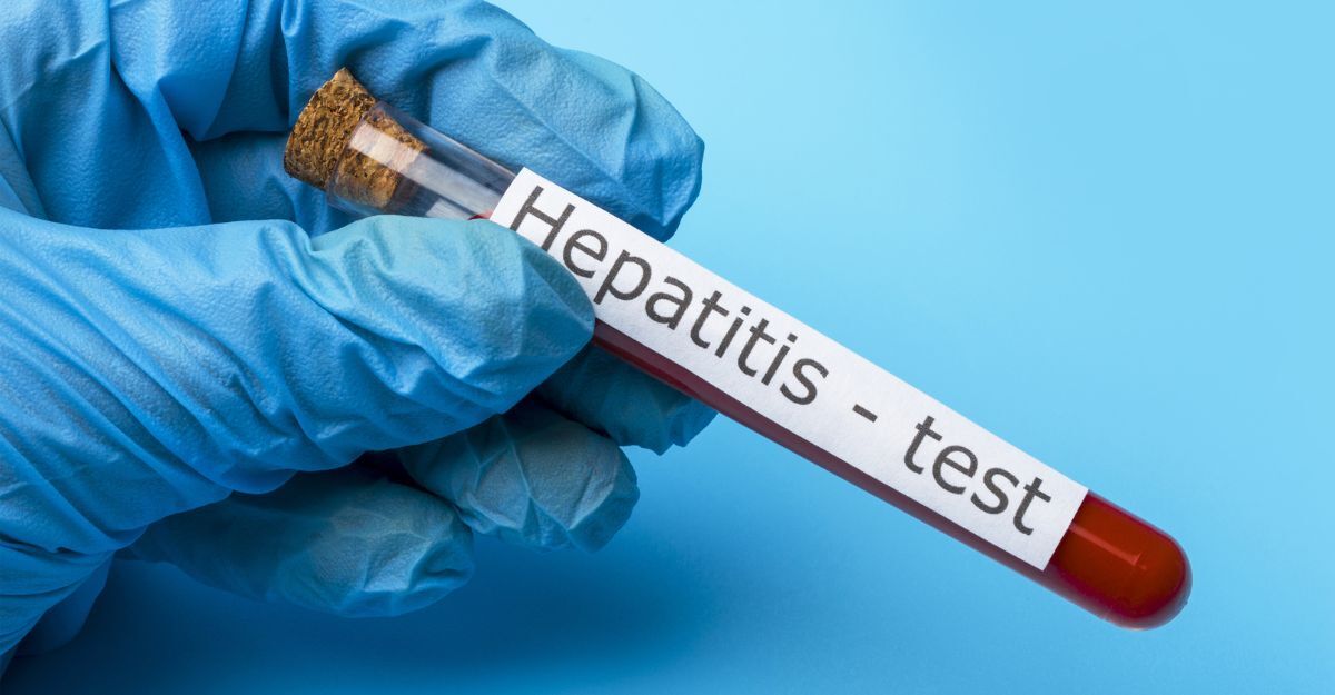 Test per l'epatite A in aumento.