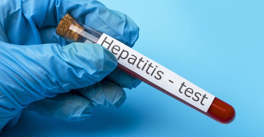 Test per l'epatite A in aumento.