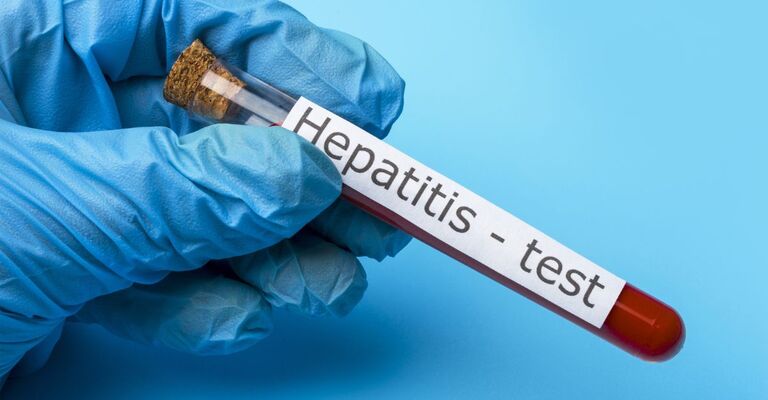 Test per l'epatite A in aumento.