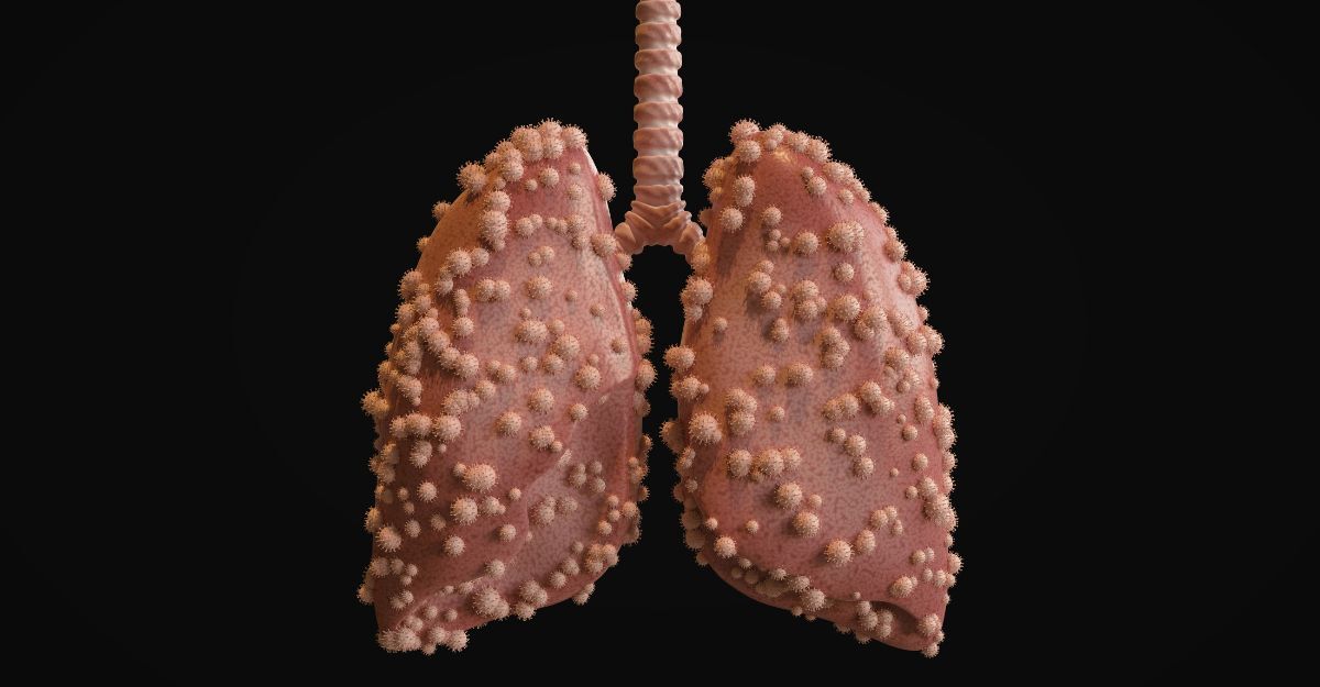 rappresentazione-di-polmoni-affetti-da-virus
