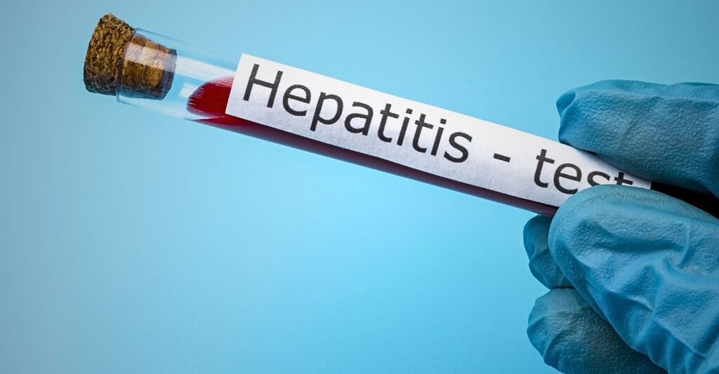 Test per l'epatite A.