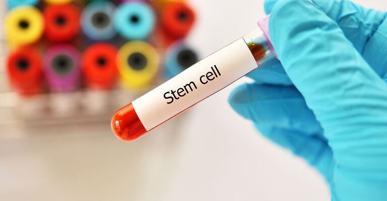 fialetta con all'interno cellule staminali