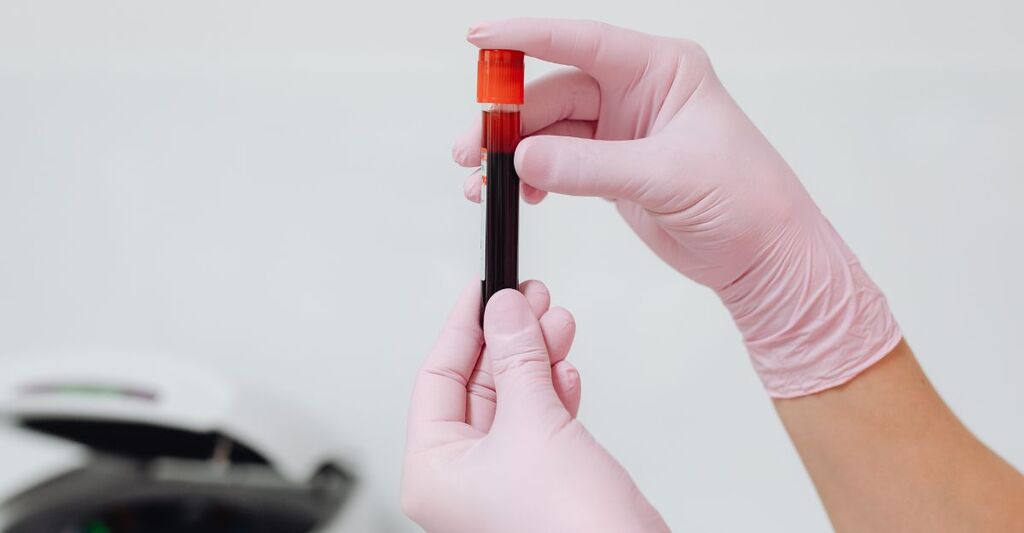 medico-tiene-una-fiala-di-sangue