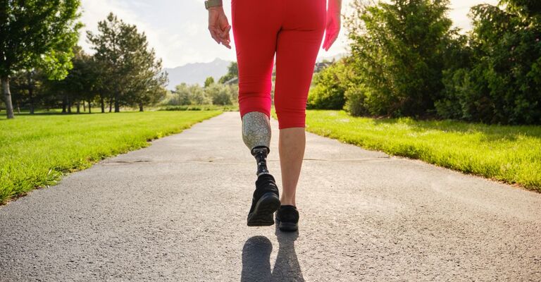 Una donna con protesi per paralisi.