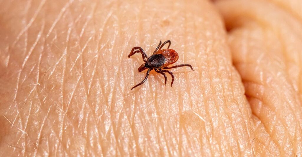 Primo piano di una zecca che cammina sulla pelle umana