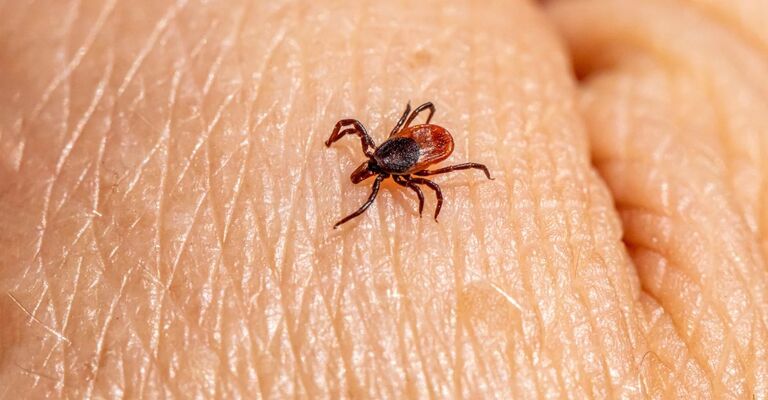 Primo piano di una zecca che cammina sulla pelle umana