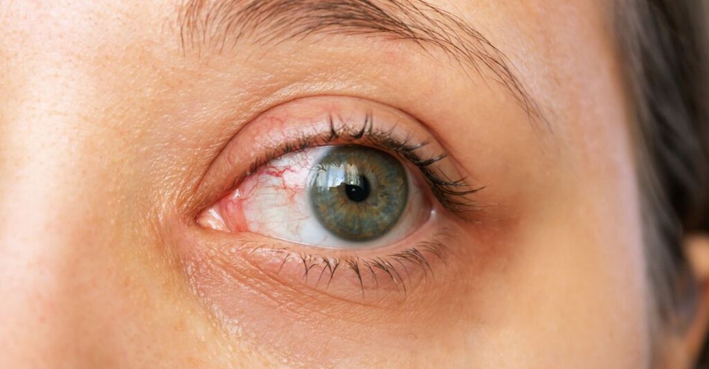 Primo piano di un occhio umano arrossato