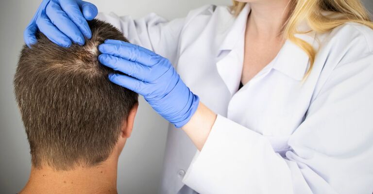 Un uomo con alopecia viene visitato da un medico per la ricrescita dei capelli.