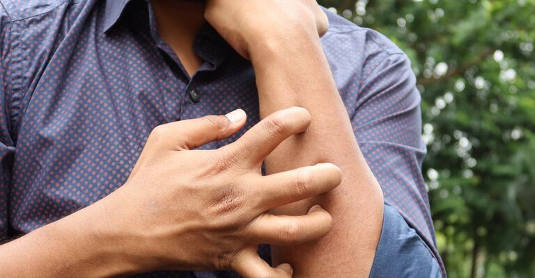 uomo si gratta il braccio