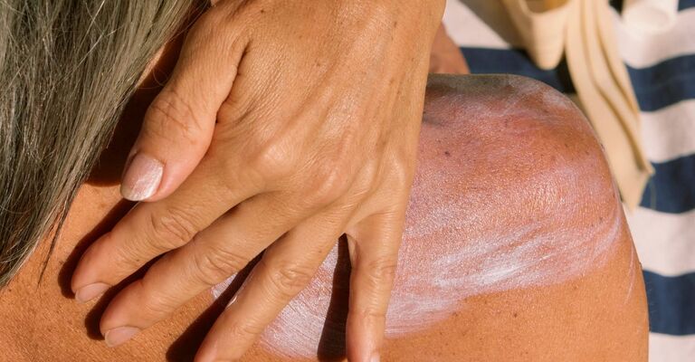 donna si spalma crema solare sulla spalla